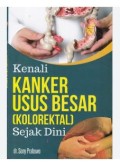 Kenali Kanker Usus Besar Kolorektal Sejak Dini