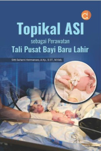 Image of Topikal ASI Sebagai Perawatan Tali Pusat Bayi Baru Lahir
